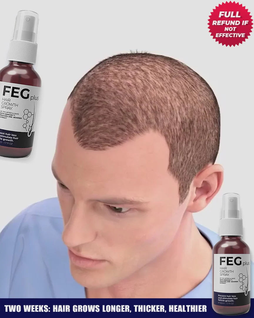 🌿 FEG Plus Hair Growth Spray 💧 | 🌟 Anti-Hair Loss Treatment for Men & Women 🧑🦱👩🦰 | ⚡ Boosts Regrowth & Thickens Hair 💪 | Minoxidil + Herbal Extracts 🌱 | 50ml Bottle