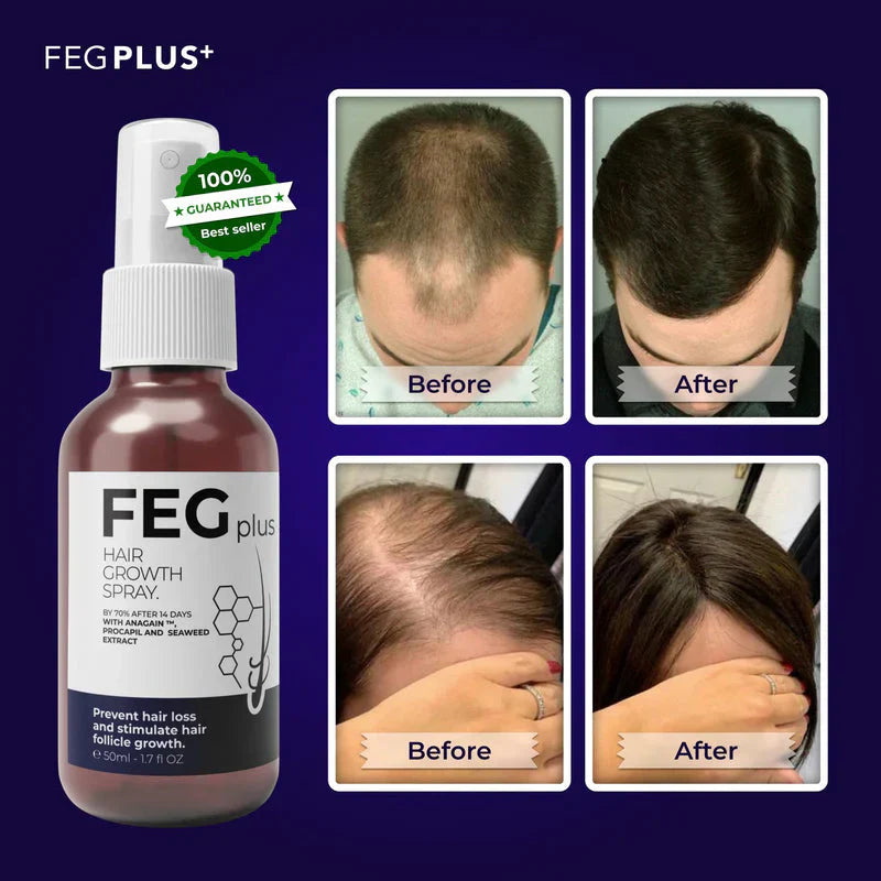 🌿 FEG Plus Hair Growth Spray 💧 | 🌟 Anti-Hair Loss Treatment for Men & Women 🧑🦱👩🦰 | ⚡ Boosts Regrowth & Thickens Hair 💪 | Minoxidil + Herbal Extracts 🌱 | 50ml Bottle