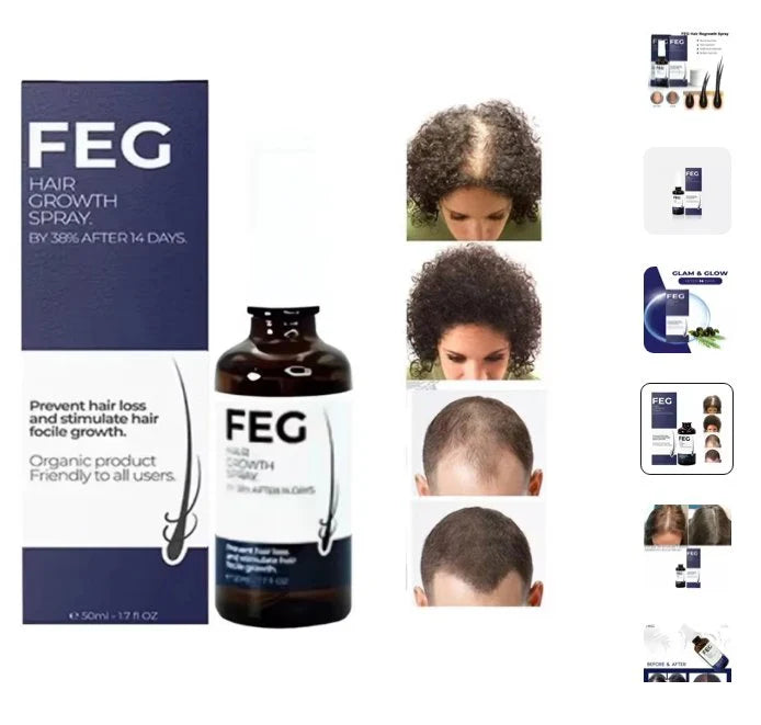 🌿 FEG Plus Hair Growth Spray 💧 | 🌟 Anti-Hair Loss Treatment for Men & Women 🧑🦱👩🦰 | ⚡ Boosts Regrowth & Thickens Hair 💪 | Minoxidil + Herbal Extracts 🌱 | 50ml Bottle